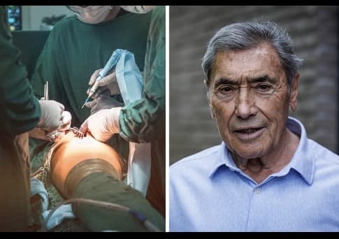 Chirurg legt uit waarom er soms complicaties optreden bij heupoperaties, zoals bij Eddy Merckx