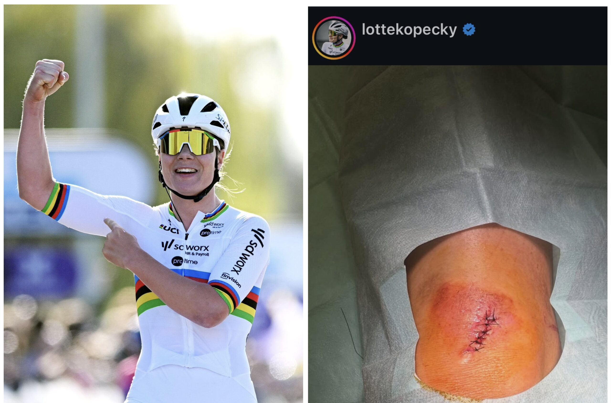 Lotte Kopecky gedwongen zich terug te trekken uit Tour de l'Ardèche na val